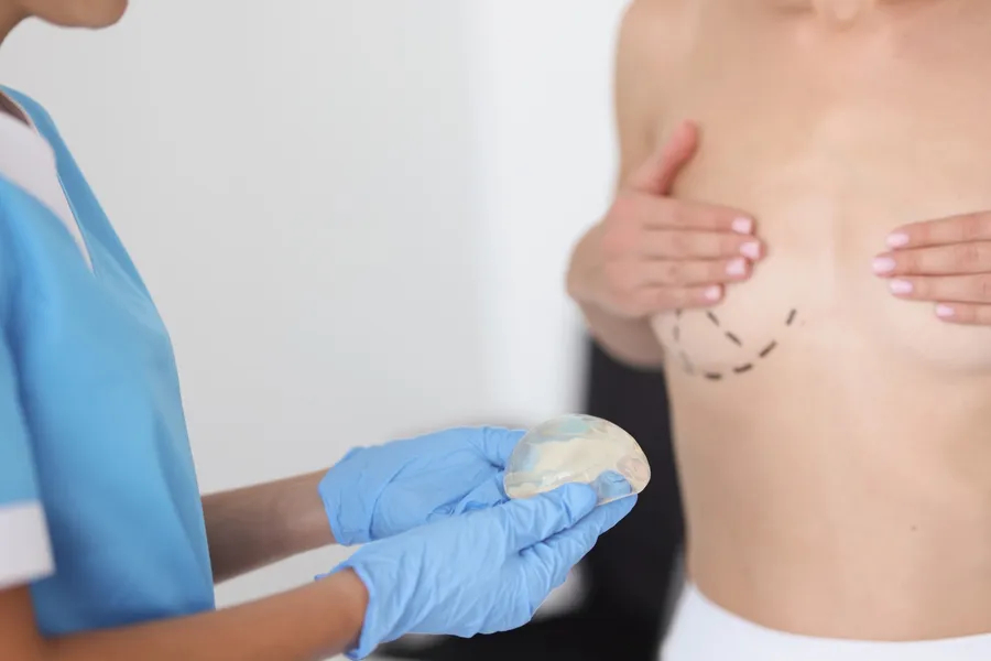 Planejamento de cirurgia de mama com prótese